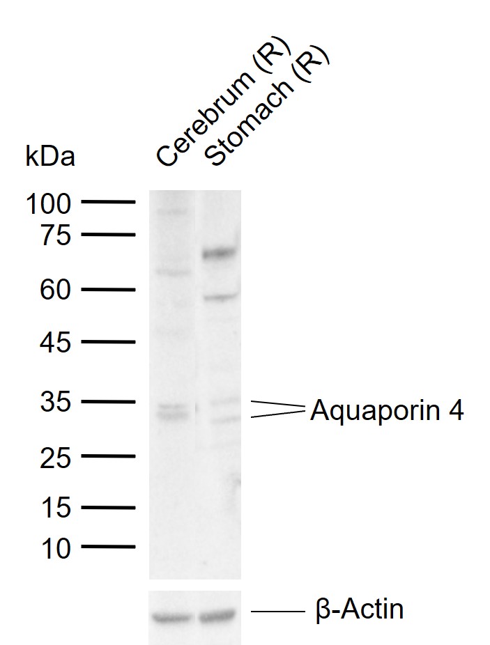 Aquaporin 4 Rabbit pAb (一抗) | Bioss