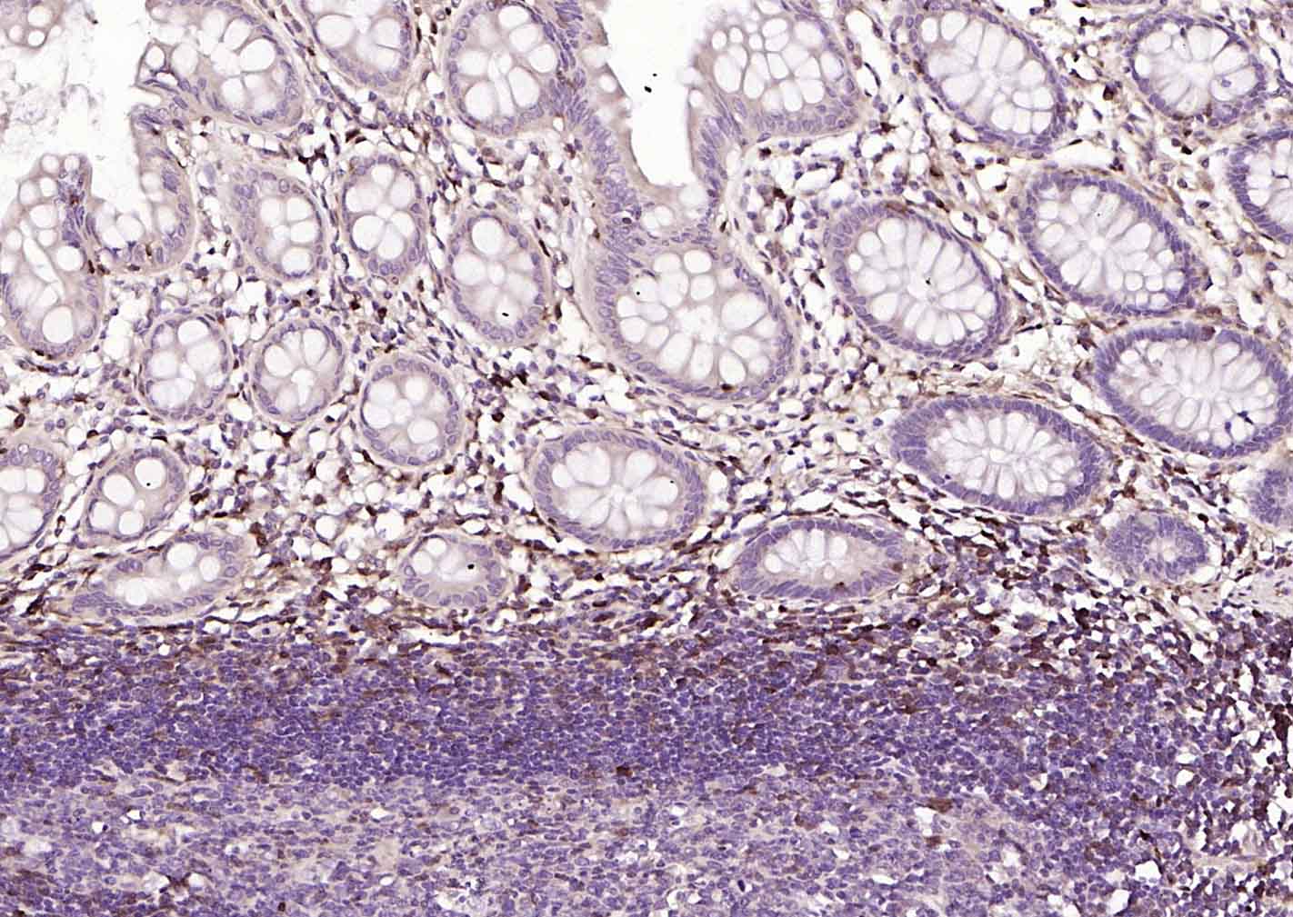 FSP-1单克隆抗体-bsm-60916M