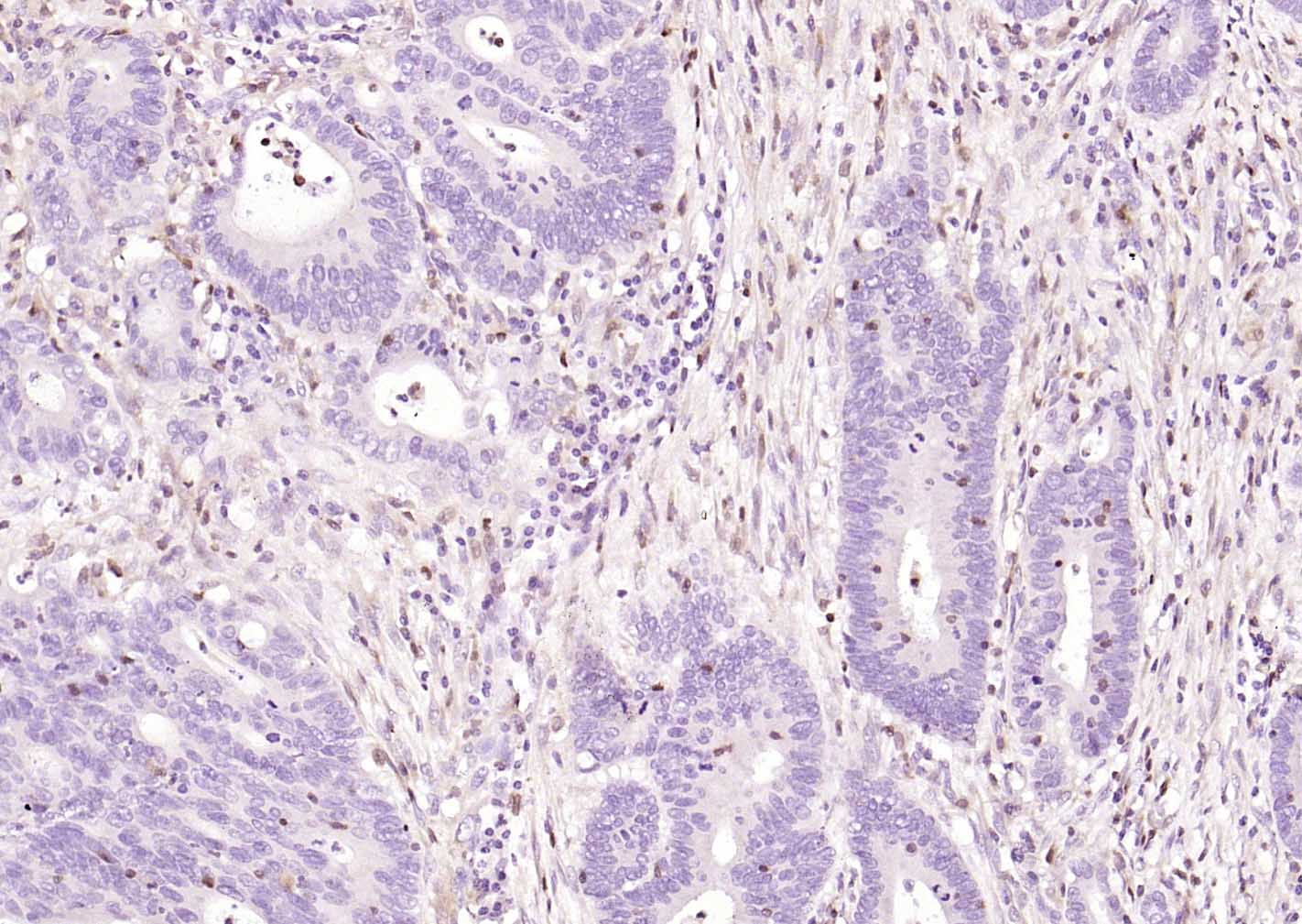 FSP-1单克隆抗体-bsm-60916M