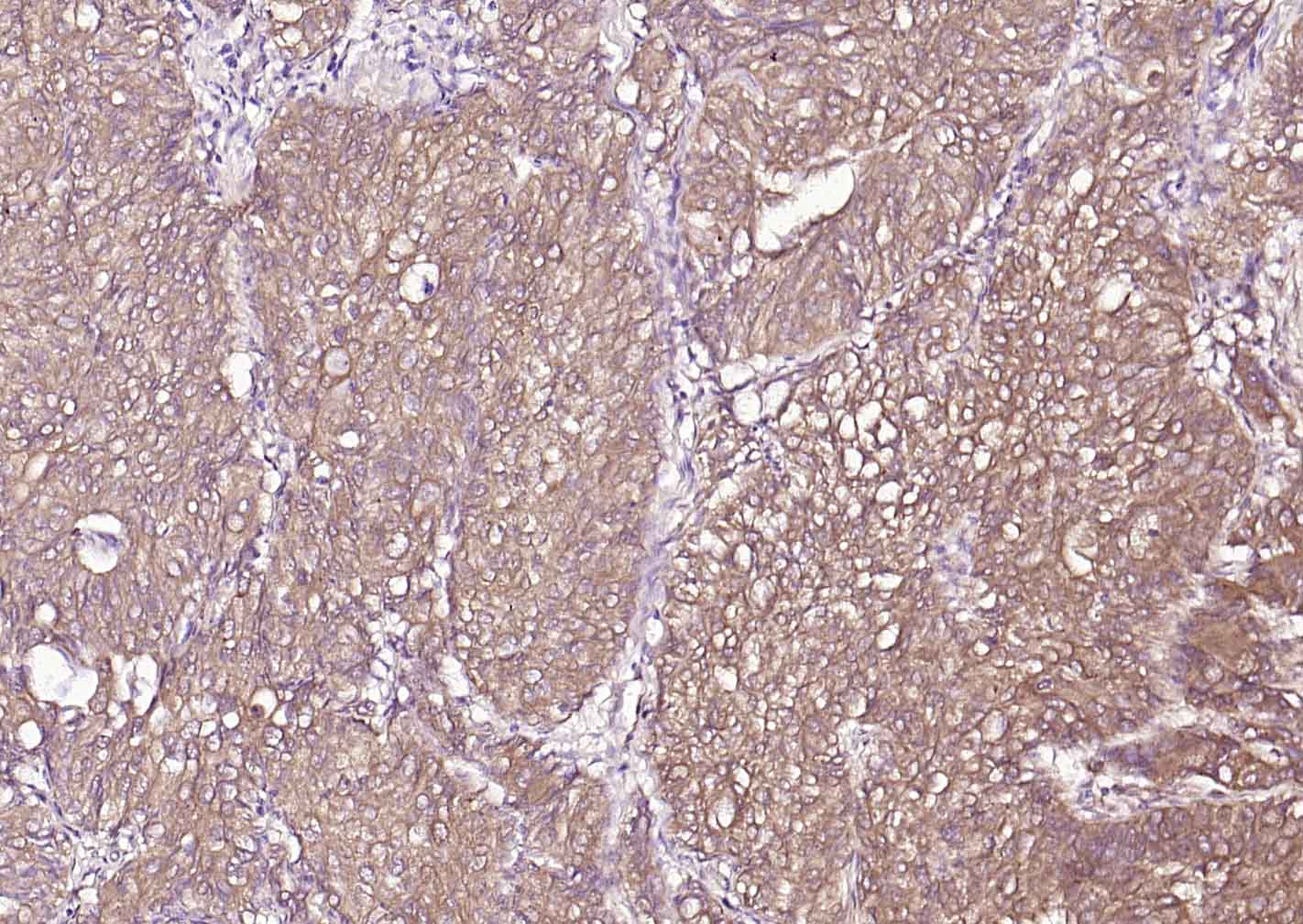 蛋白质二硫键异构酶重组小鼠单抗-bsm-60312M
