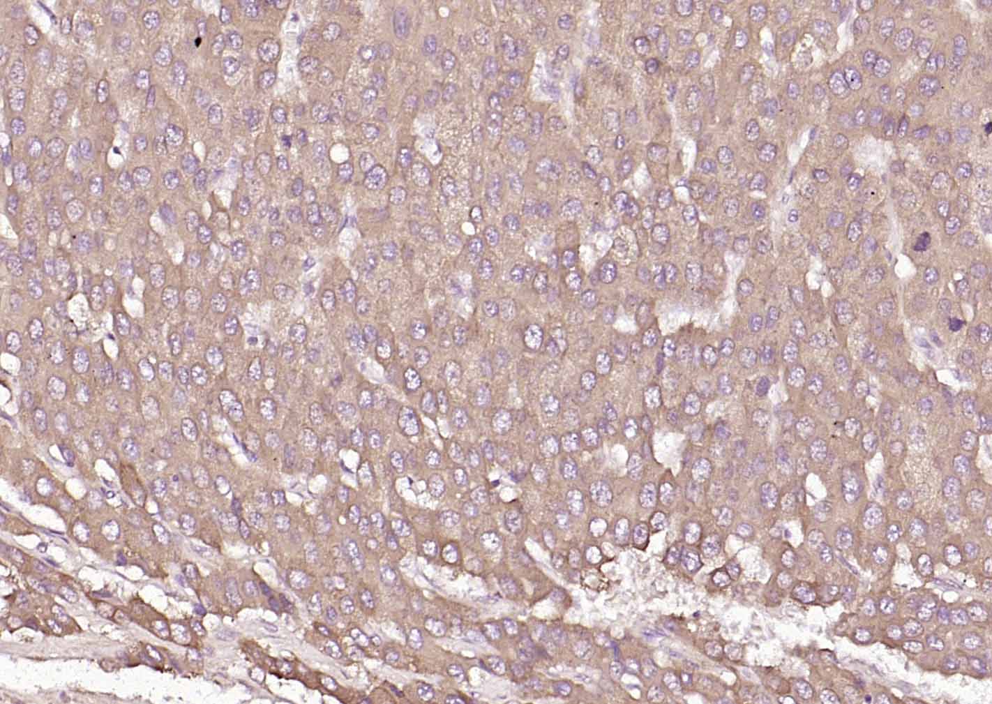 蛋白质二硫键异构酶重组小鼠单抗-bsm-60312M