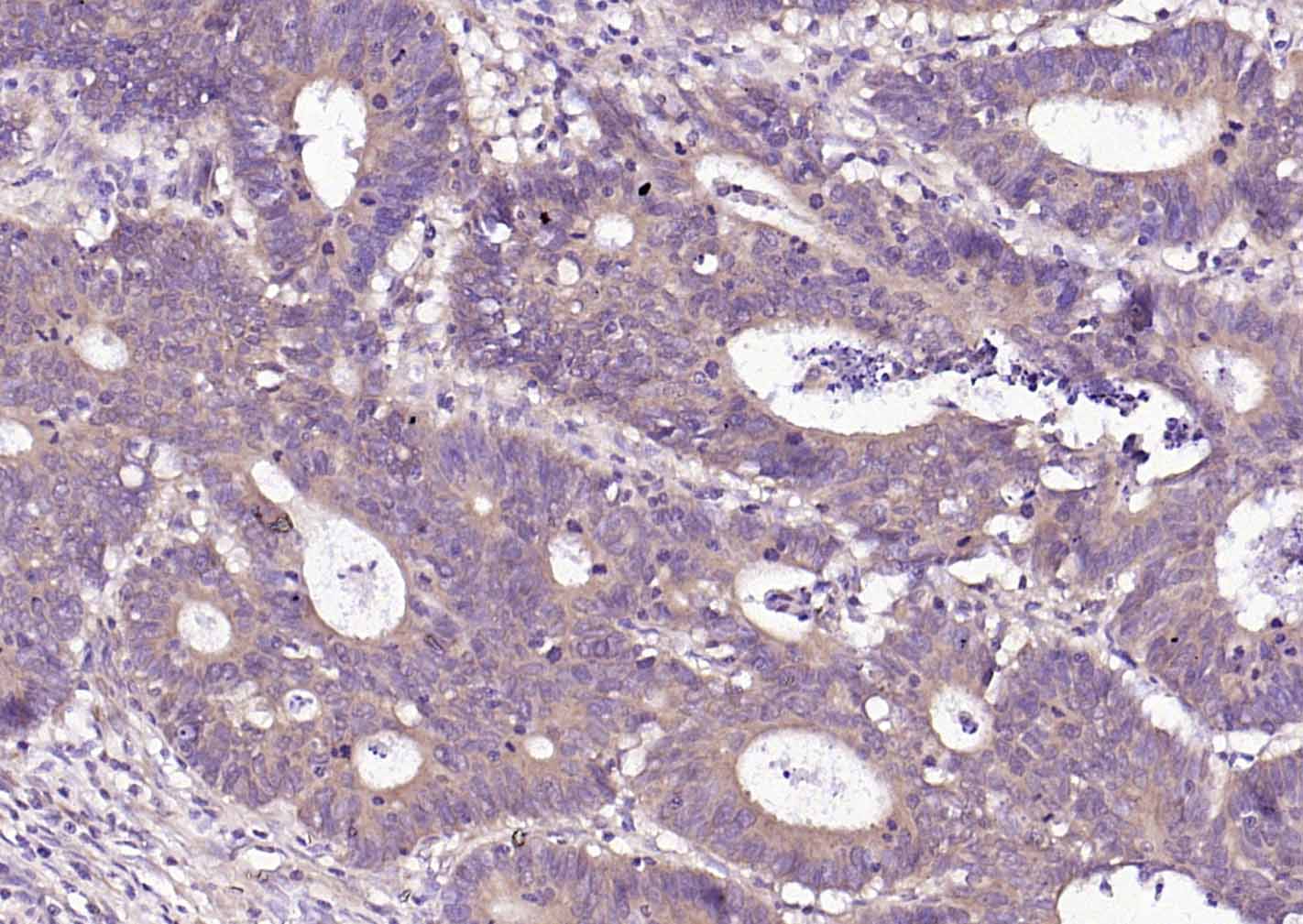 蛋白质二硫键异构酶重组小鼠单抗-bsm-60312M