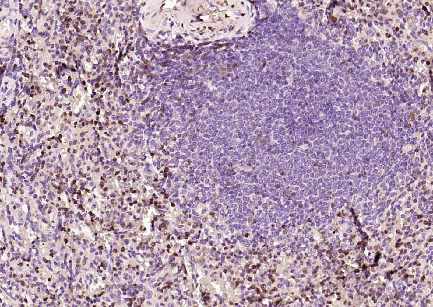 FSP-1单克隆抗体-bsm-60916M