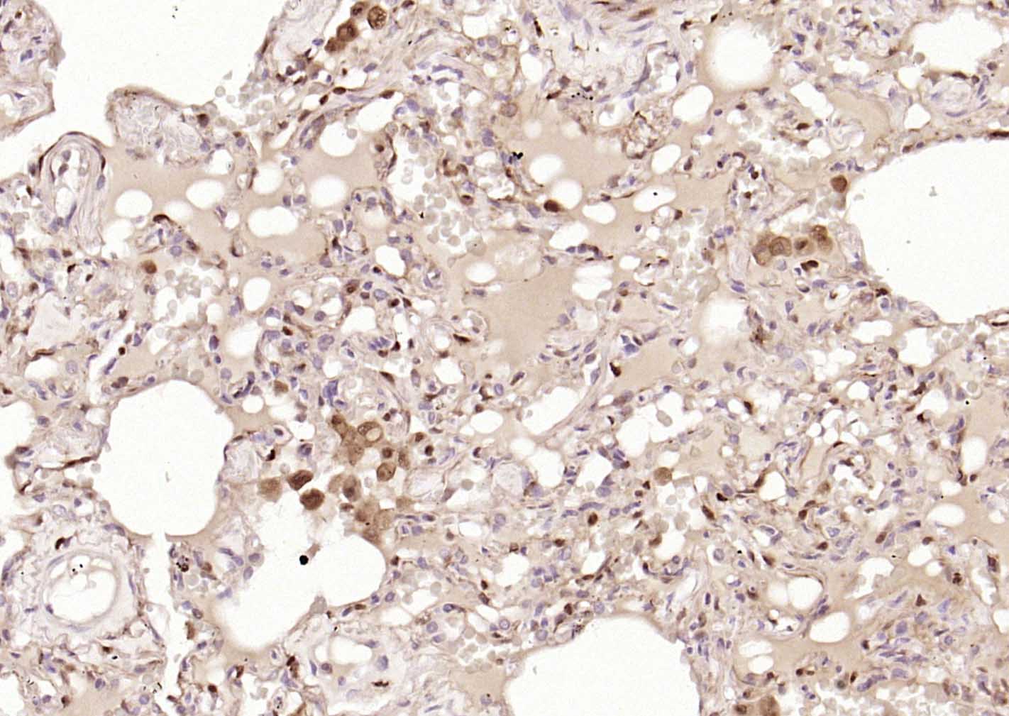 FSP-1单克隆抗体-bsm-60916M