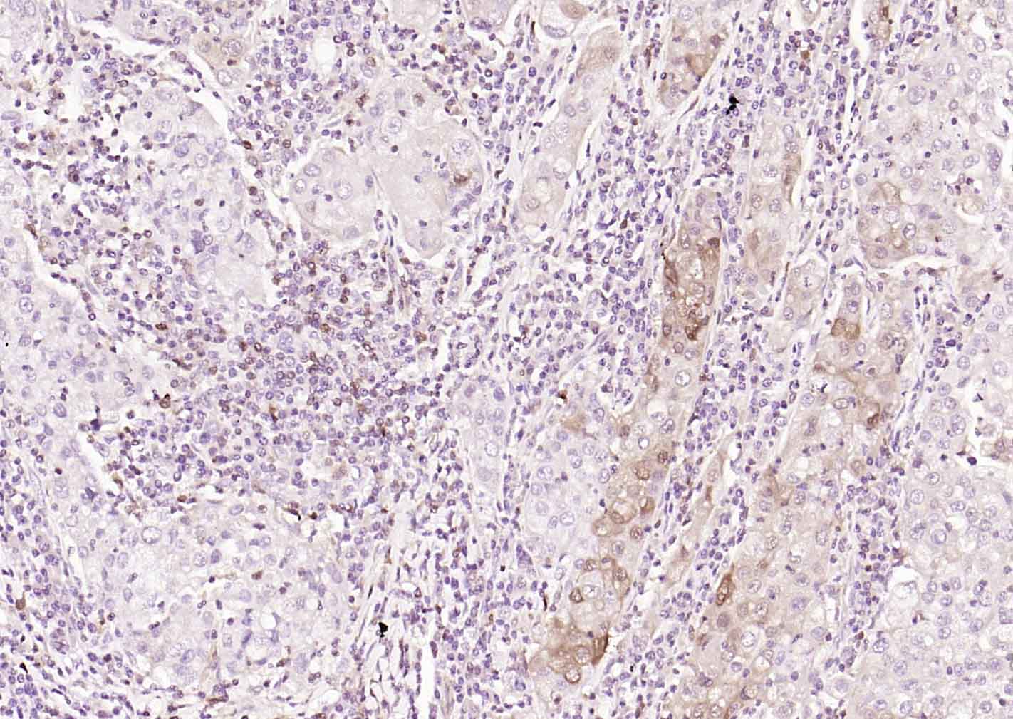 FSP-1单克隆抗体-bsm-60916M