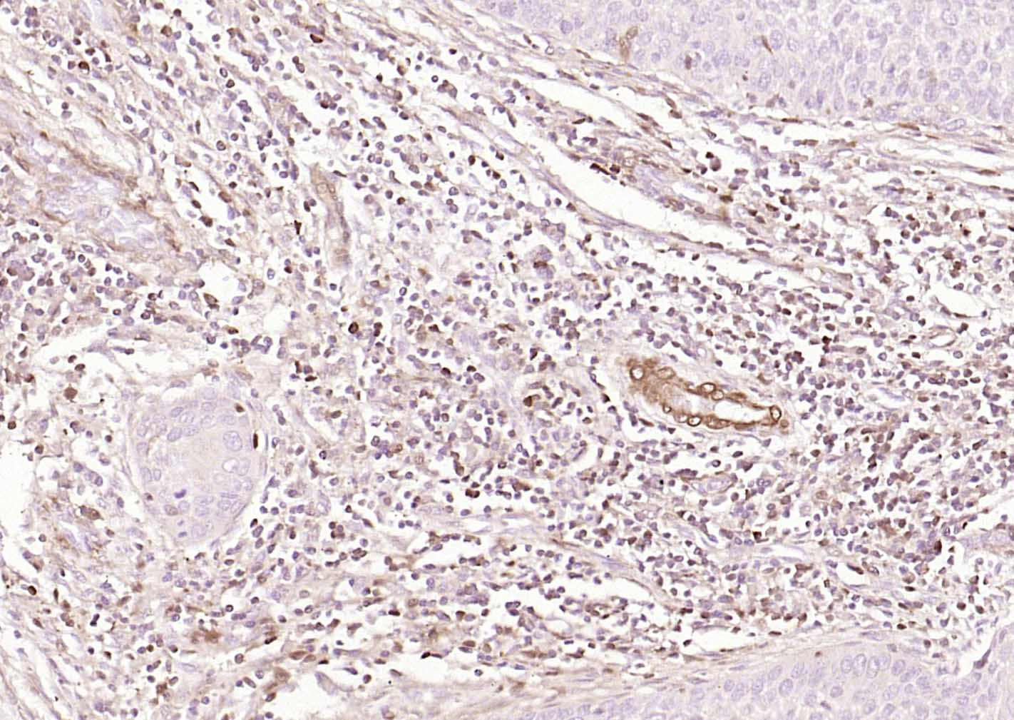 FSP-1单克隆抗体-bsm-60916M