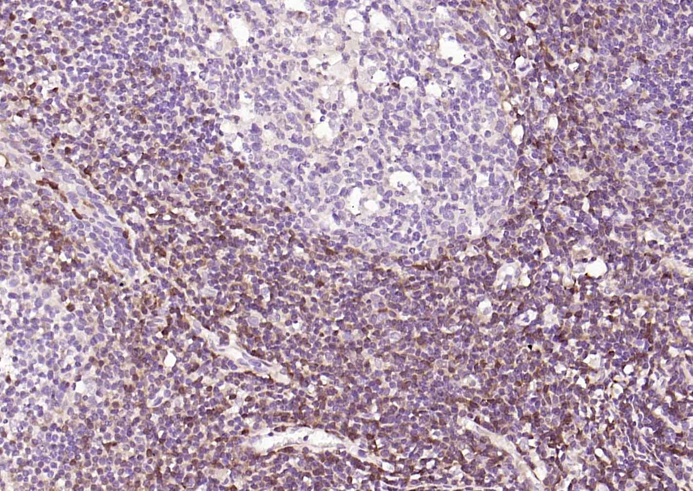S100A4 Mouse mAb (一抗) - IHC-P,IHC-F,IF | Bioss