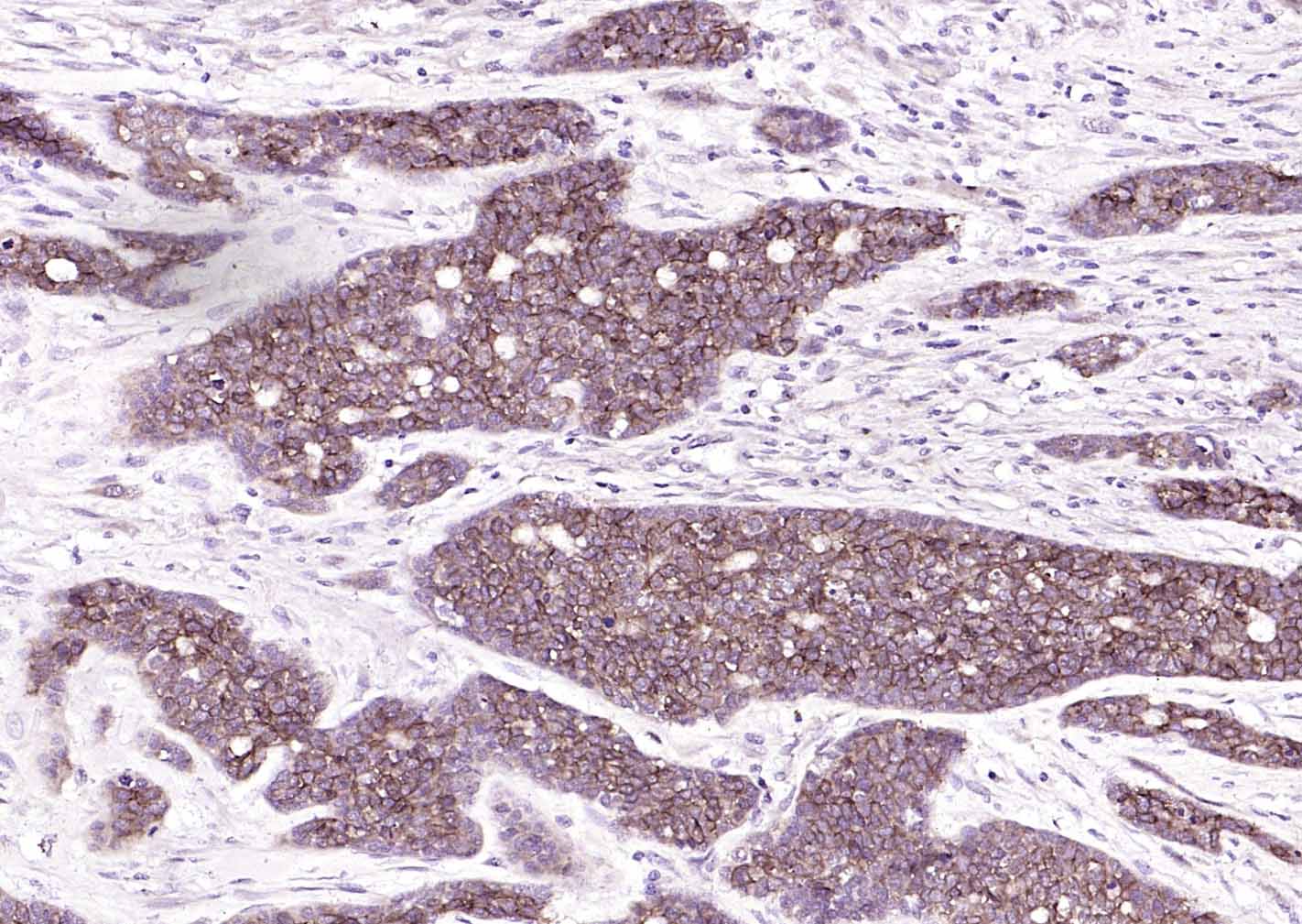 上皮细胞粘附分子（CD326）重组兔单抗