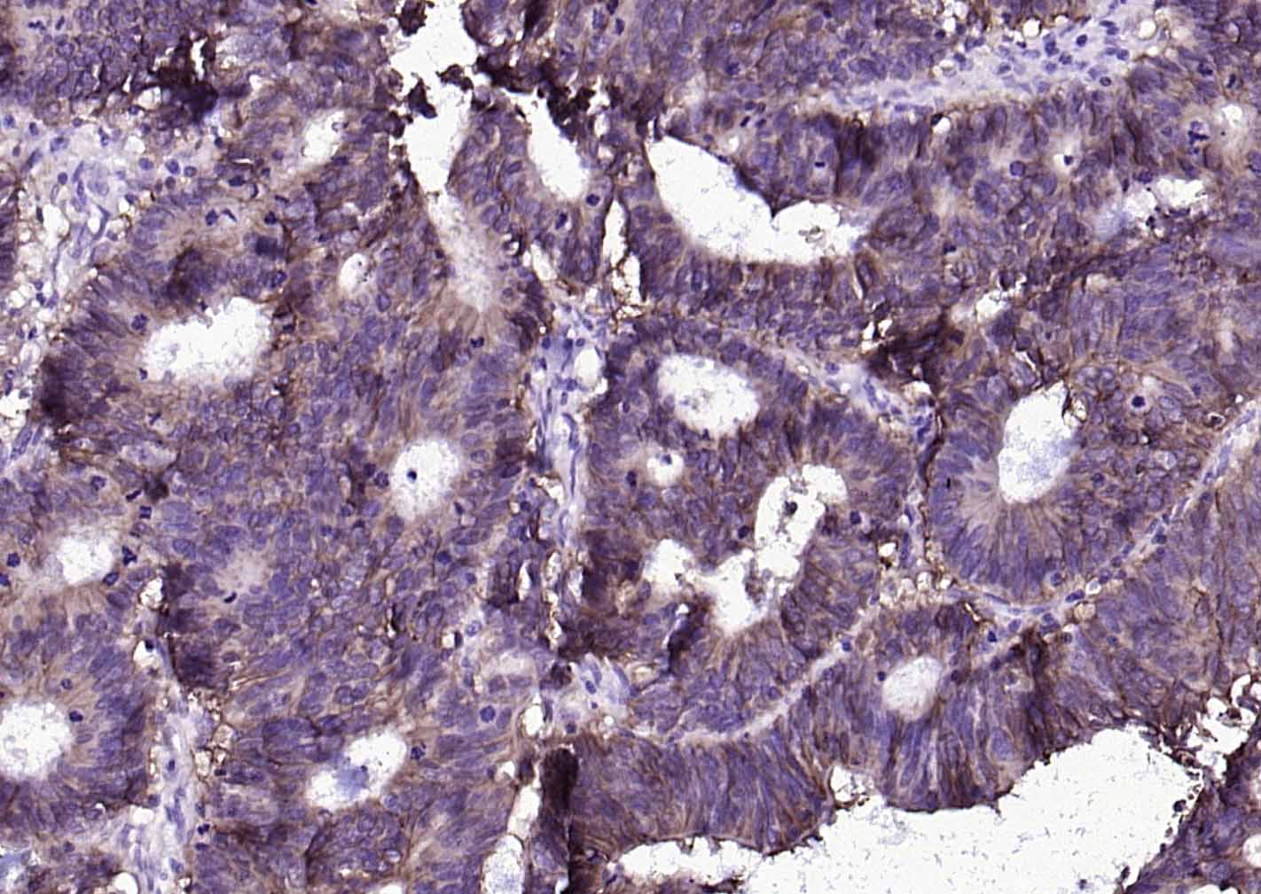 上皮细胞粘附分子（CD326）重组兔单抗