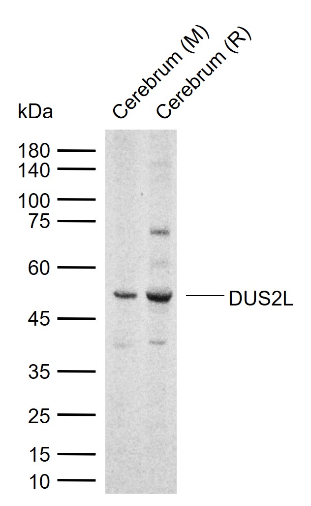 DUS2L Rabbit pAb (一抗) | Bioss