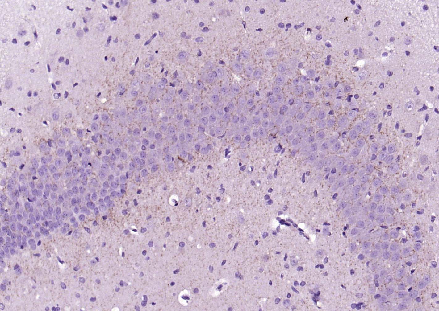 钙粘蛋白相关的神经受体1抗体-bs-1683R