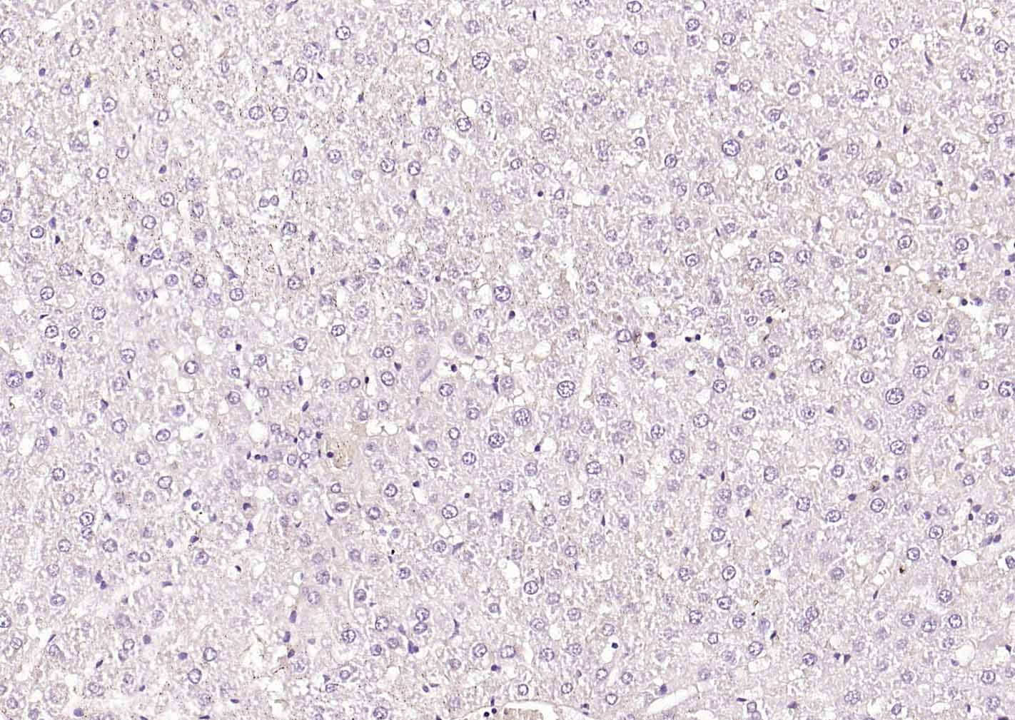 钙粘蛋白相关的神经受体1抗体-bs-1683R