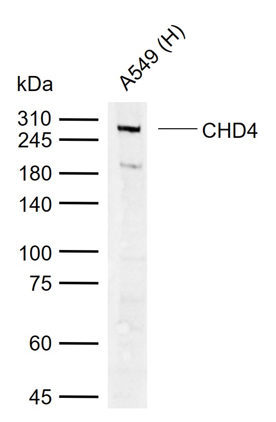 CHD4 Rabbit pAb (一抗) | Bioss
