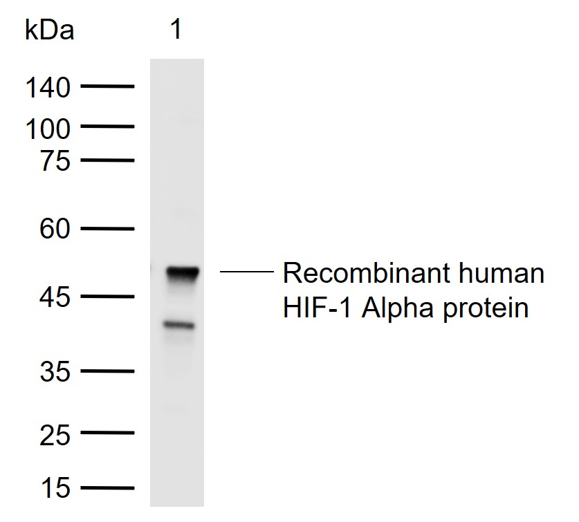 缺氧诱导因子1α /HIF-1α抗体-bs-20399R