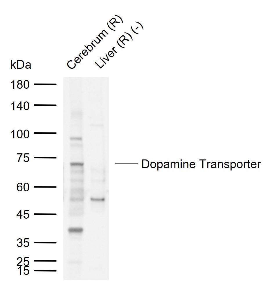 Dopamine Transporter Rabbit pAb (一抗) | Bioss