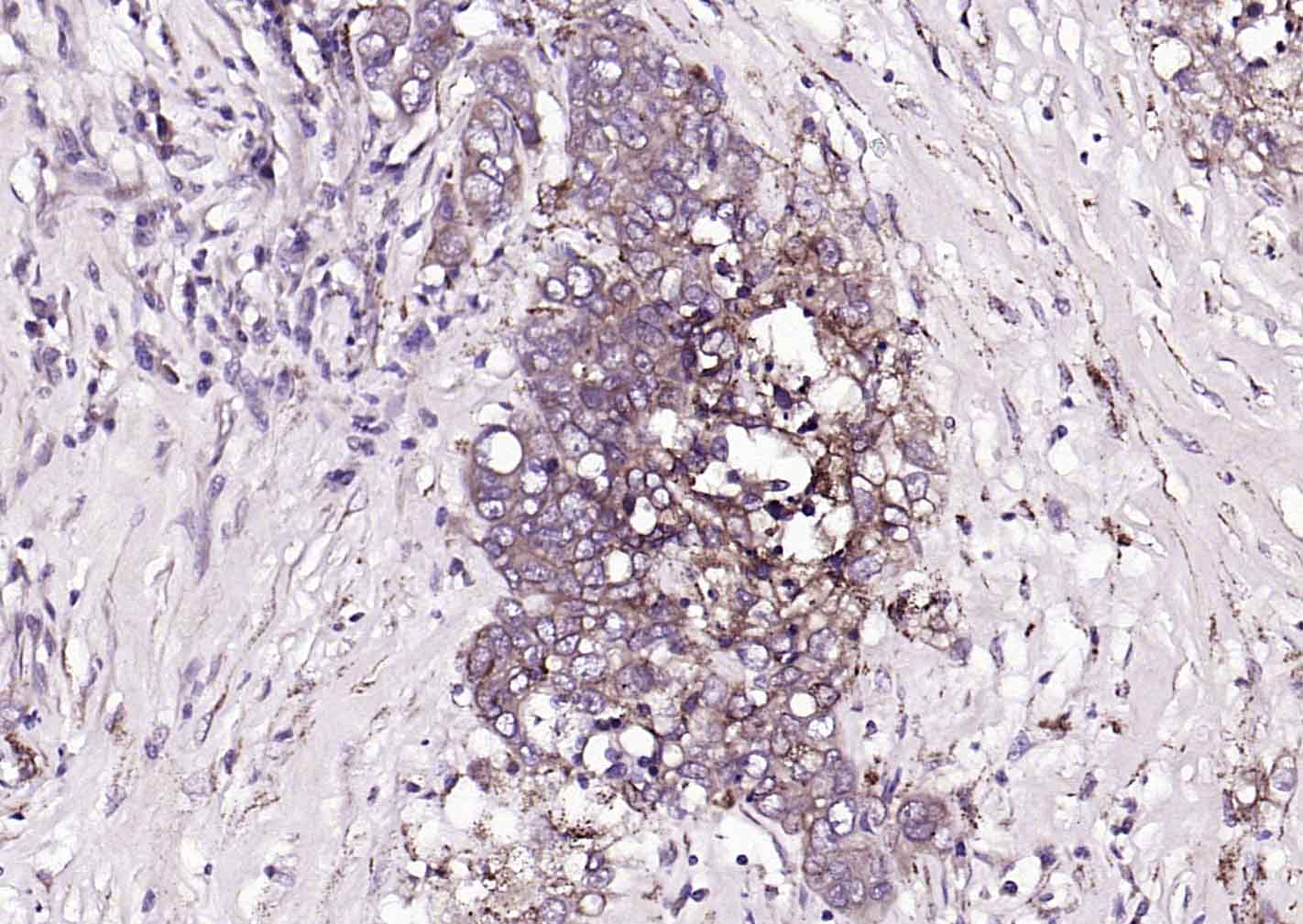 转移生长因子β受体2抗体-bs-0117R