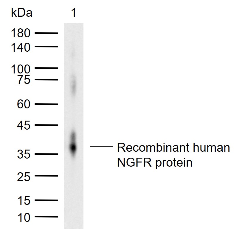 NGFR/p75NTR Rabbit pAb (一抗) | Bioss