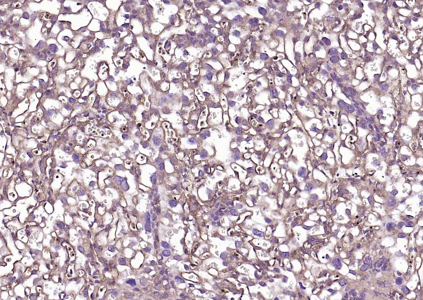 TGF beta Receptor II Rabbit pAb (一抗) - IHC-P,IHC-F,IF | Bioss