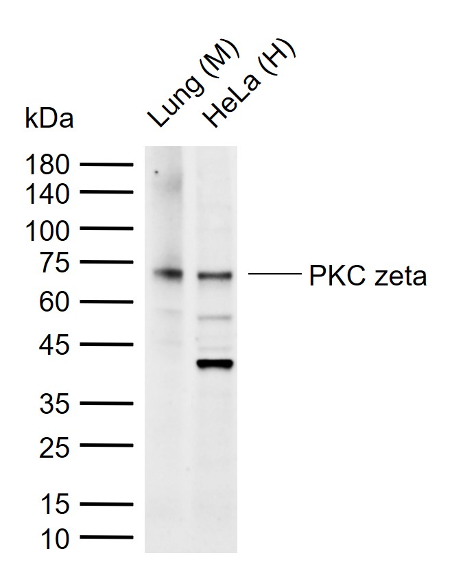 蛋白激酶C zeta重组兔单抗