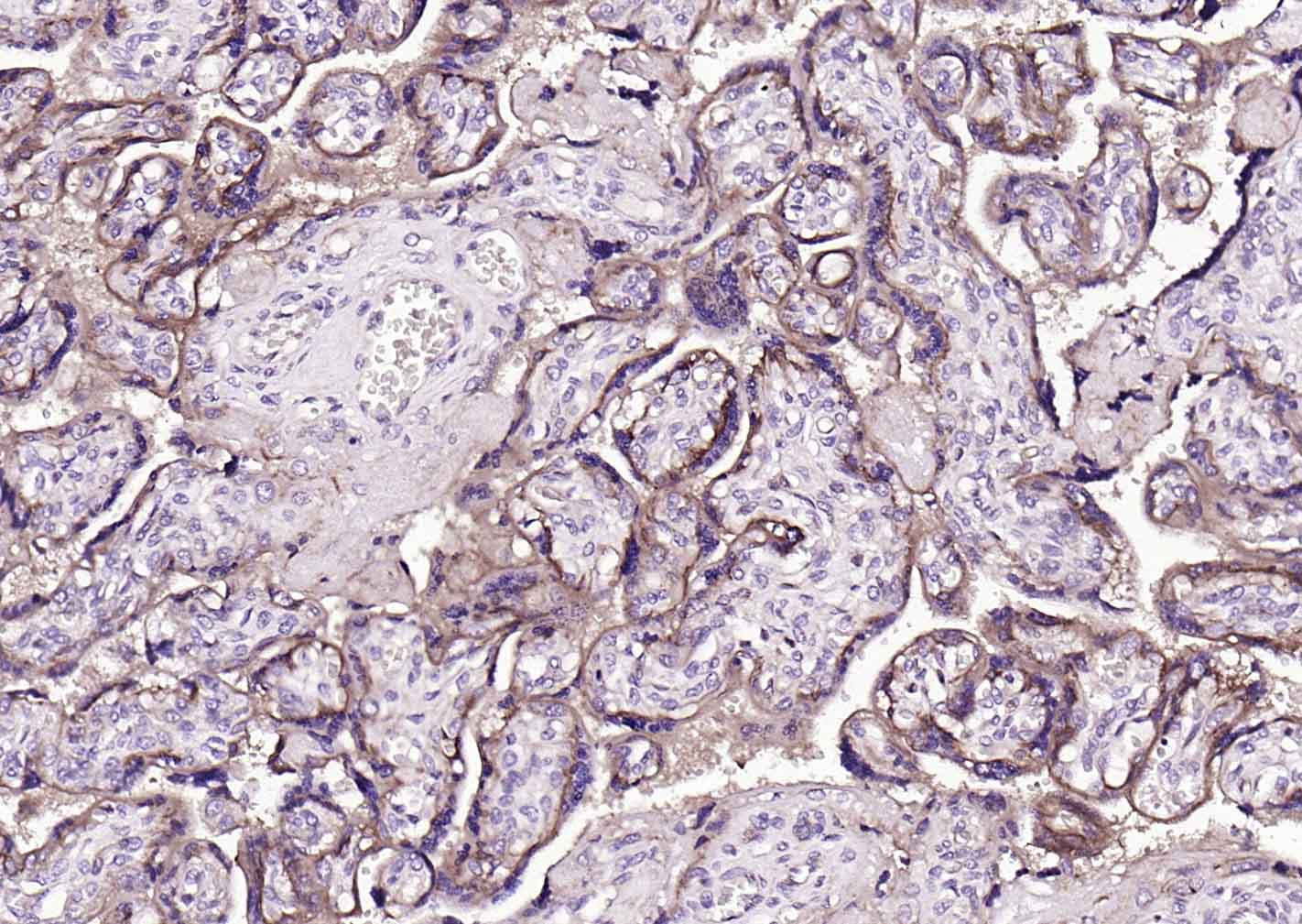 转移生长因子β受体2抗体-bs-0117R