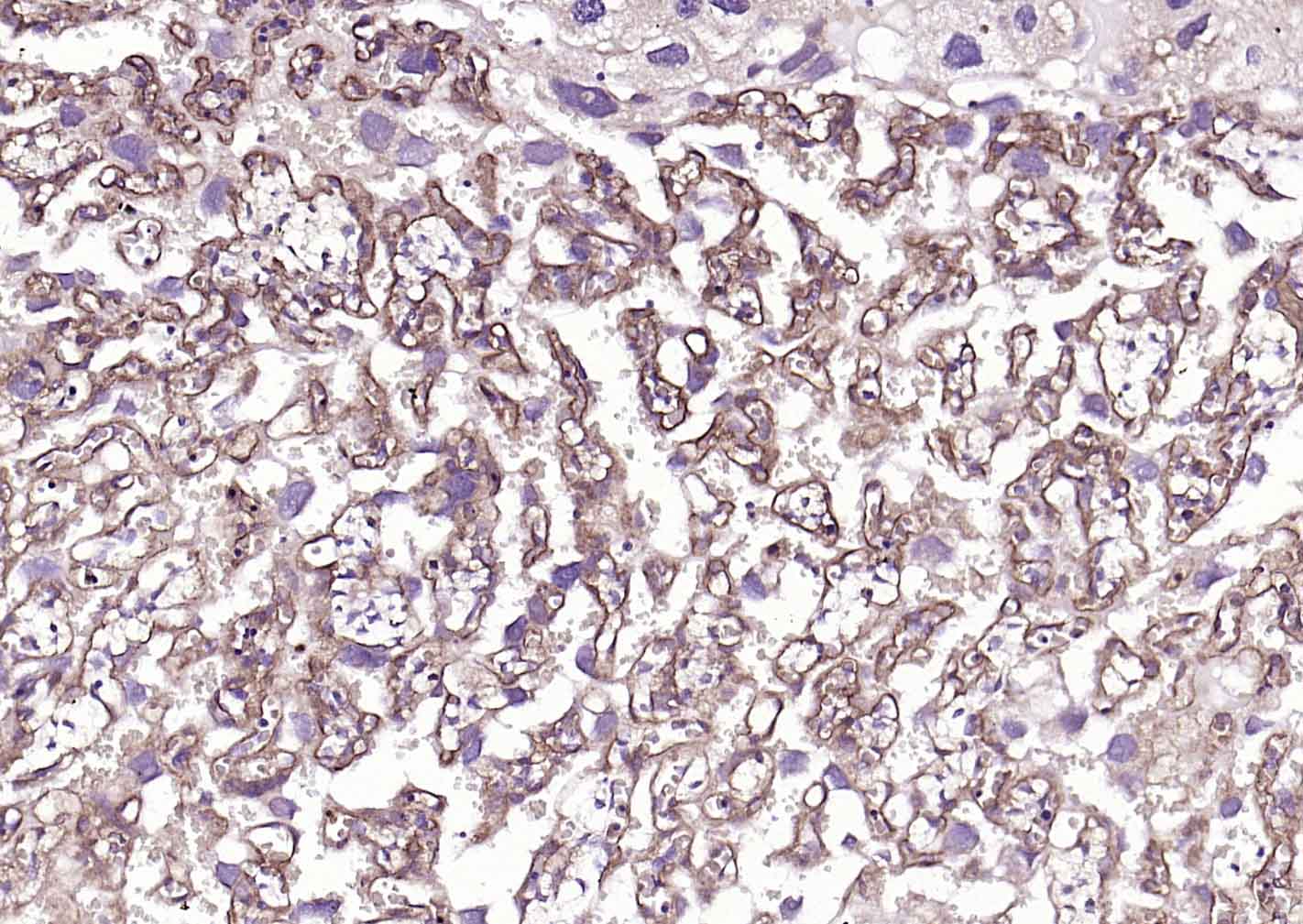 转移生长因子β受体2抗体-bs-0117R