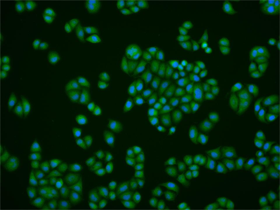 磷酸化组蛋白去乙酰化酶2抗体-bs-5389R