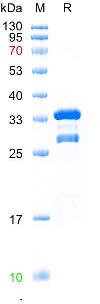Recombinant human OPRM1 protein, N-GST (重组蛋白) | Bioss