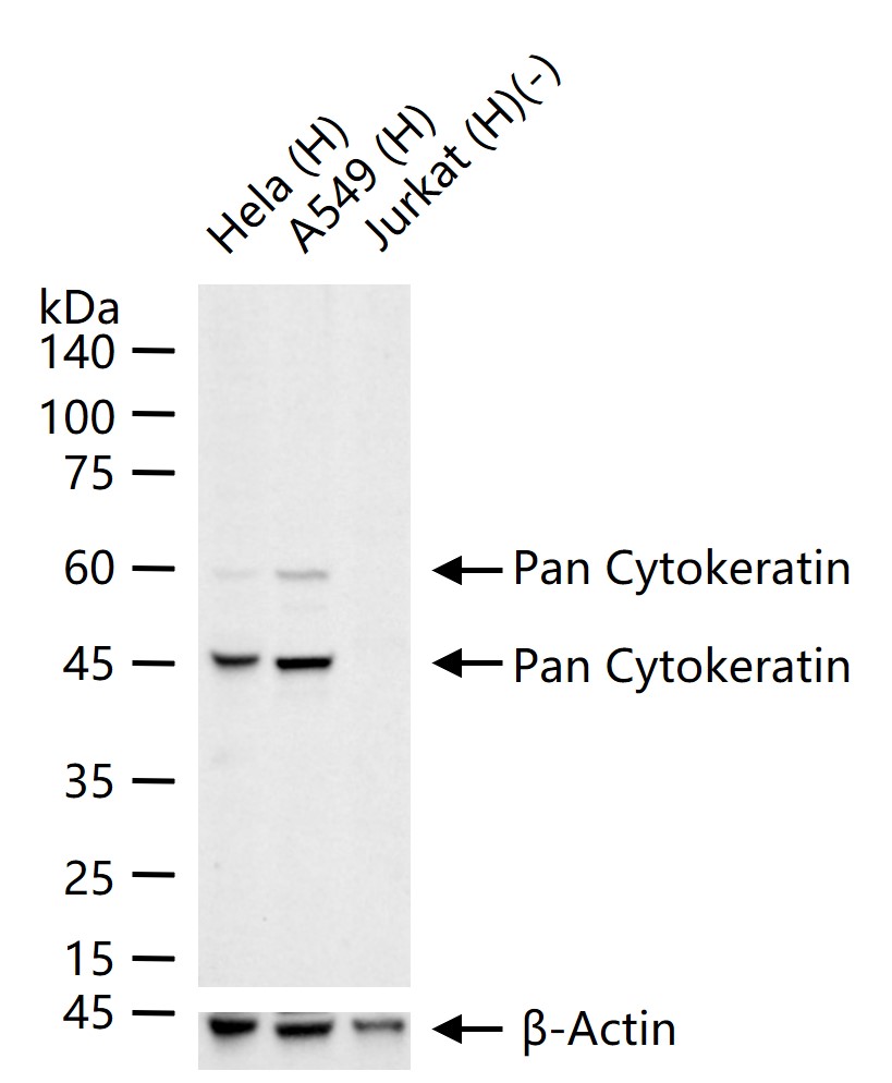 广谱细胞角蛋白PCK单克隆抗体