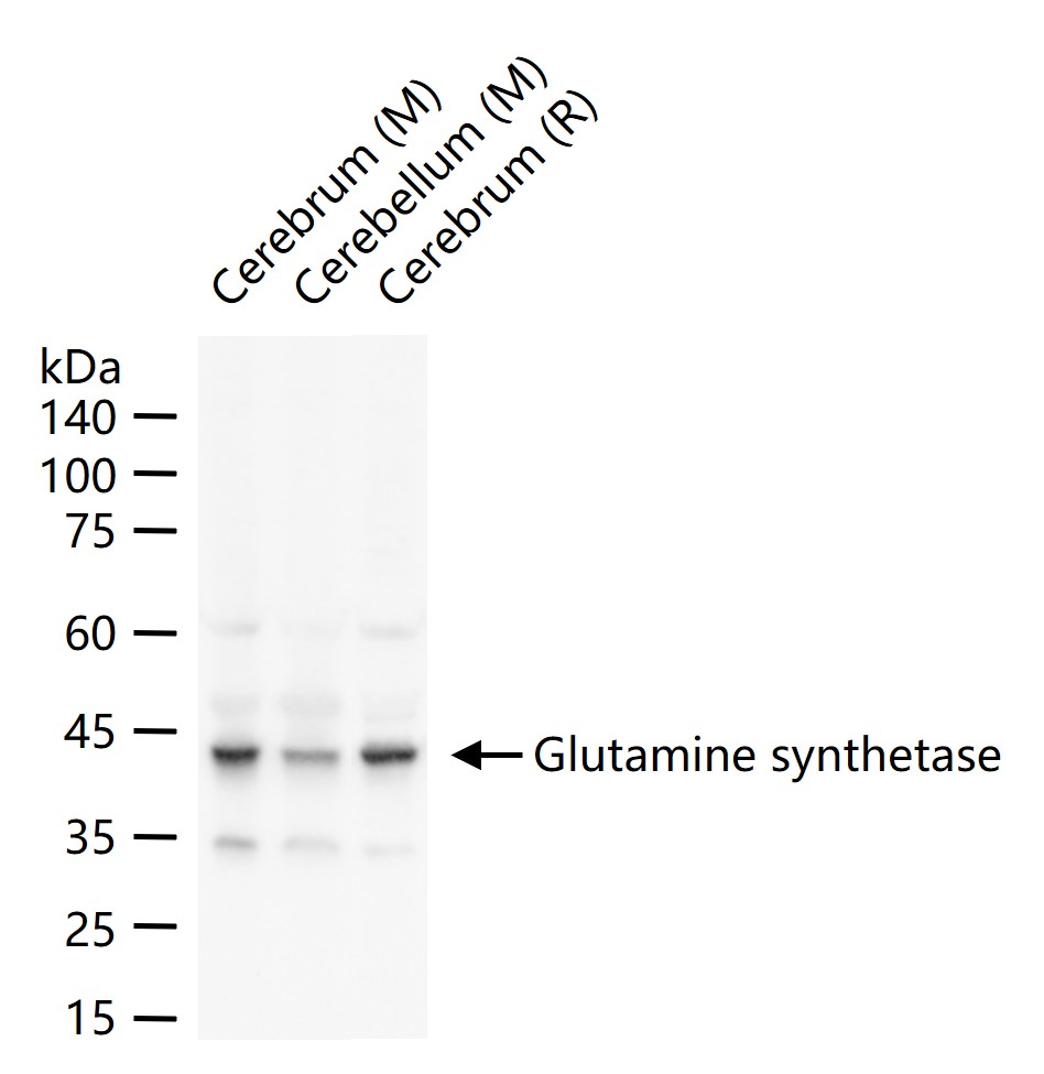 Glutamine synthetase Rabbit pAb (一抗) - WB,IHC-P,IHC-F,IF | Bioss