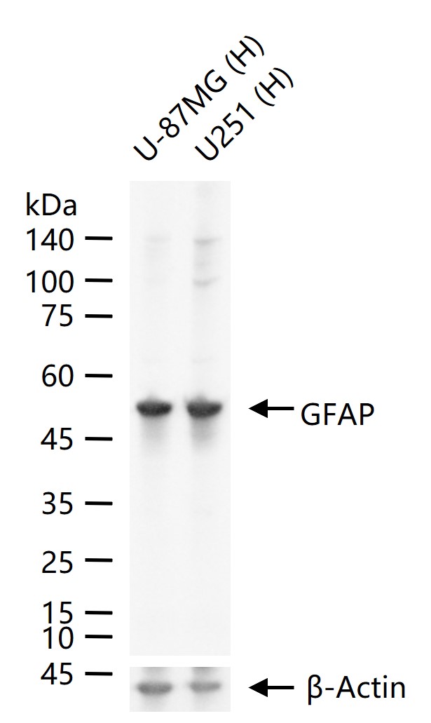GFAP Rabbit pAb (一抗) - WB,Flow-Cyt,ICC/IF,ELISA | Bioss