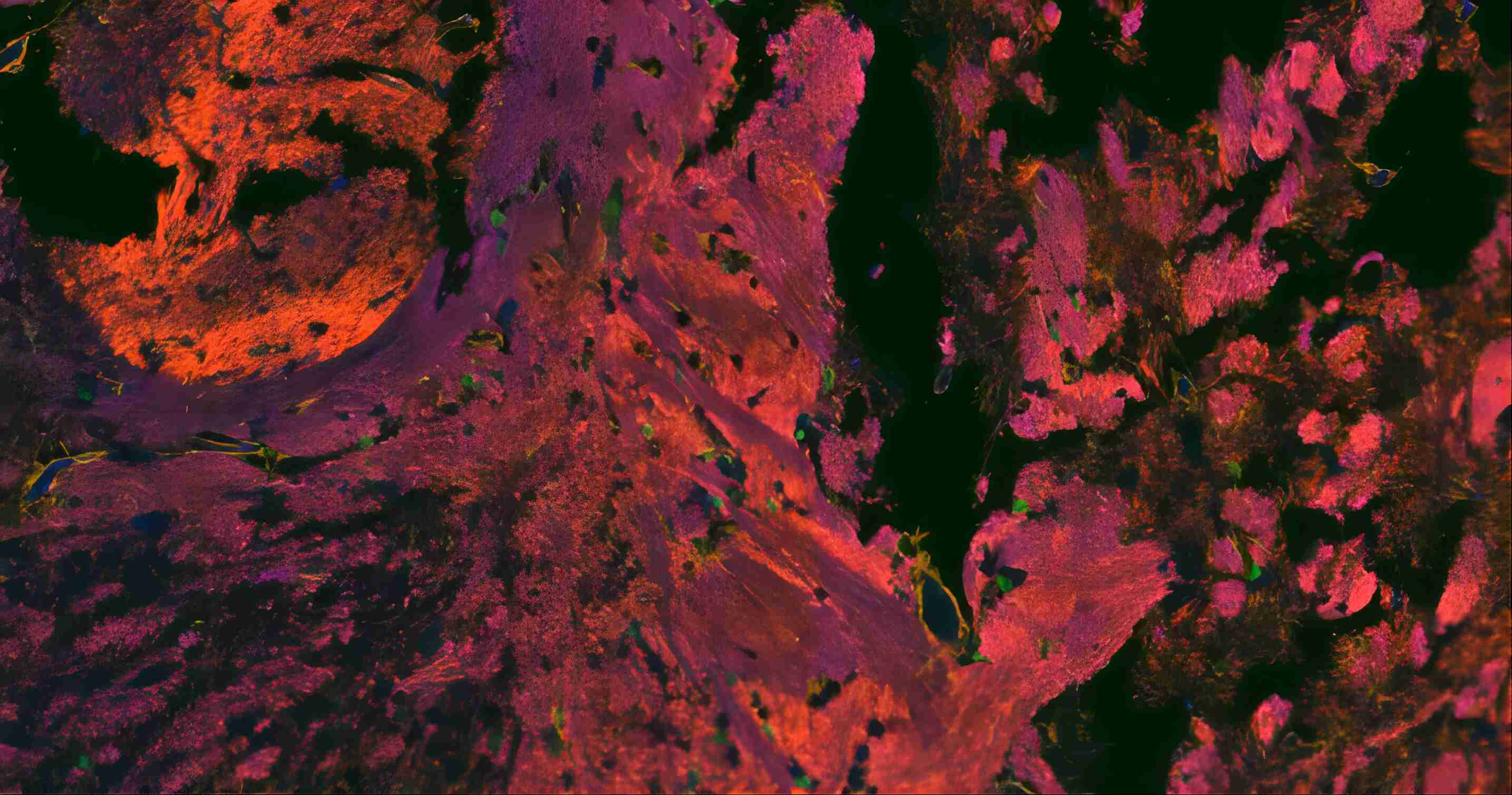 四标五色多重荧光检测试剂盒-IHCT003