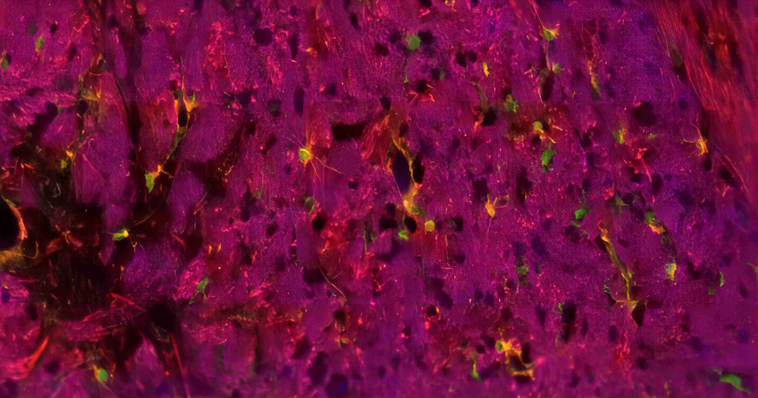 四标五色多重荧光检测试剂盒-IHCT003