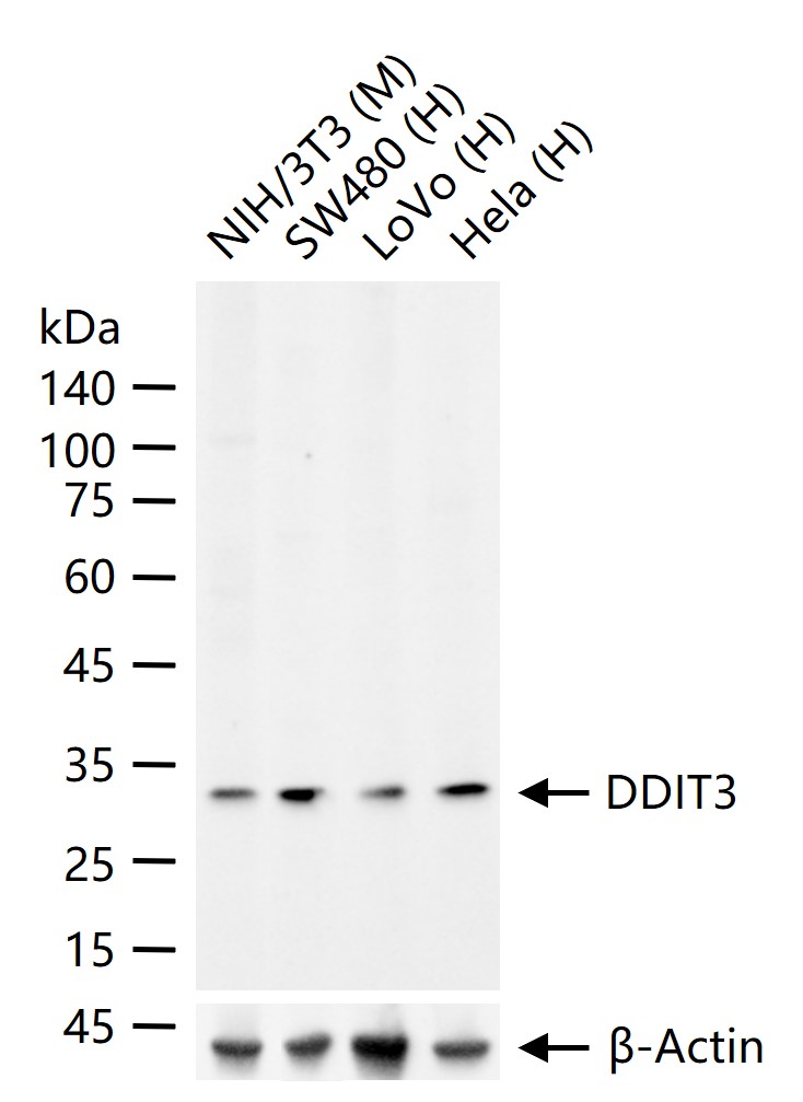 DDIT3 Rabbit pAb (一抗) - WB,IHC-P,IHC-F,IF | Bioss