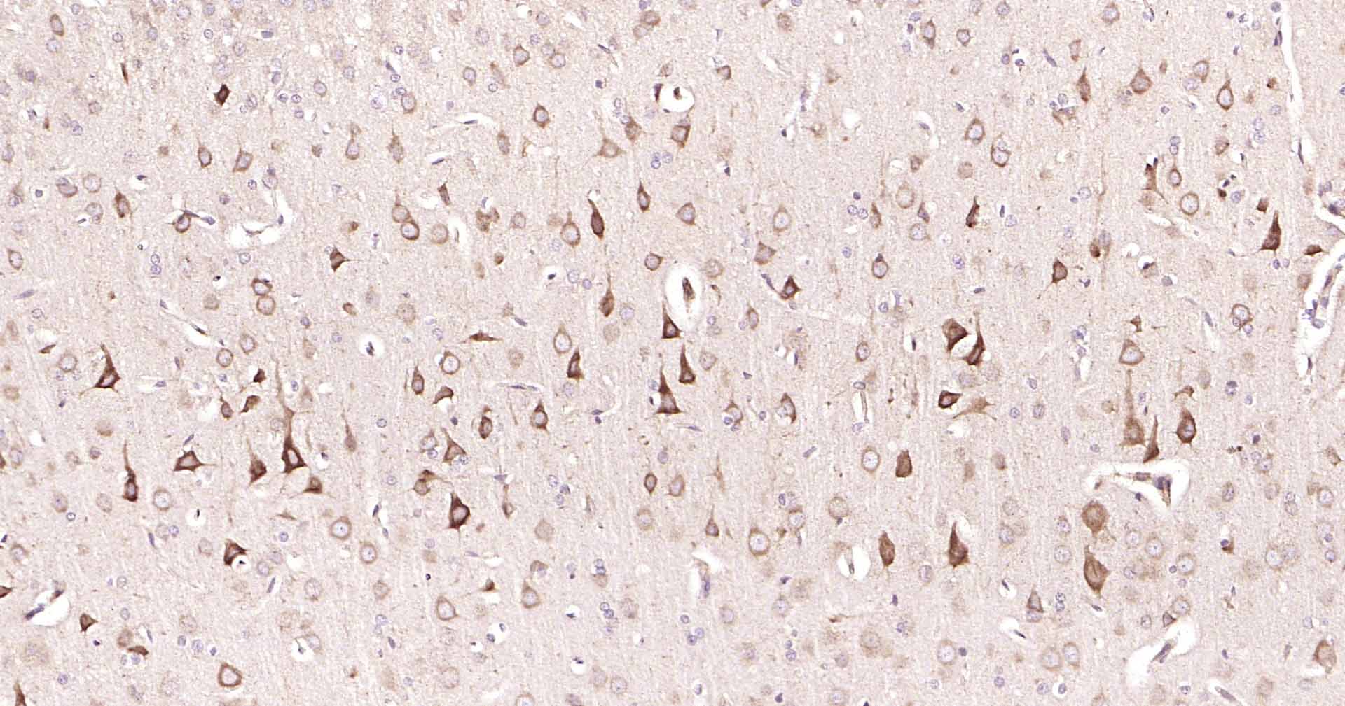 GADD153抗体-bs-20669R