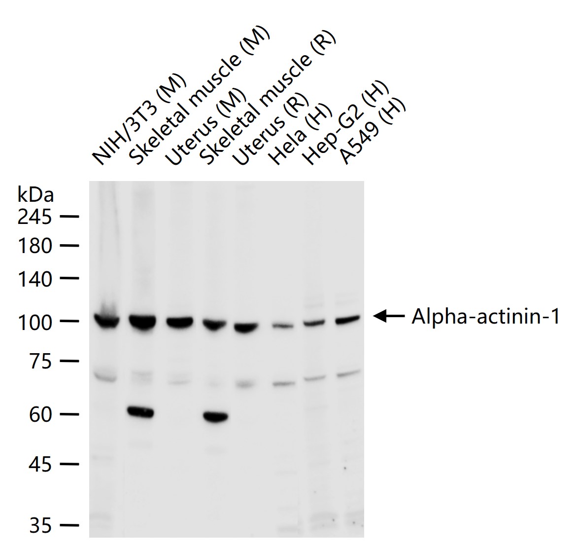 Alpha-actinin-1 Rabbit pAb (一抗) | Bioss
