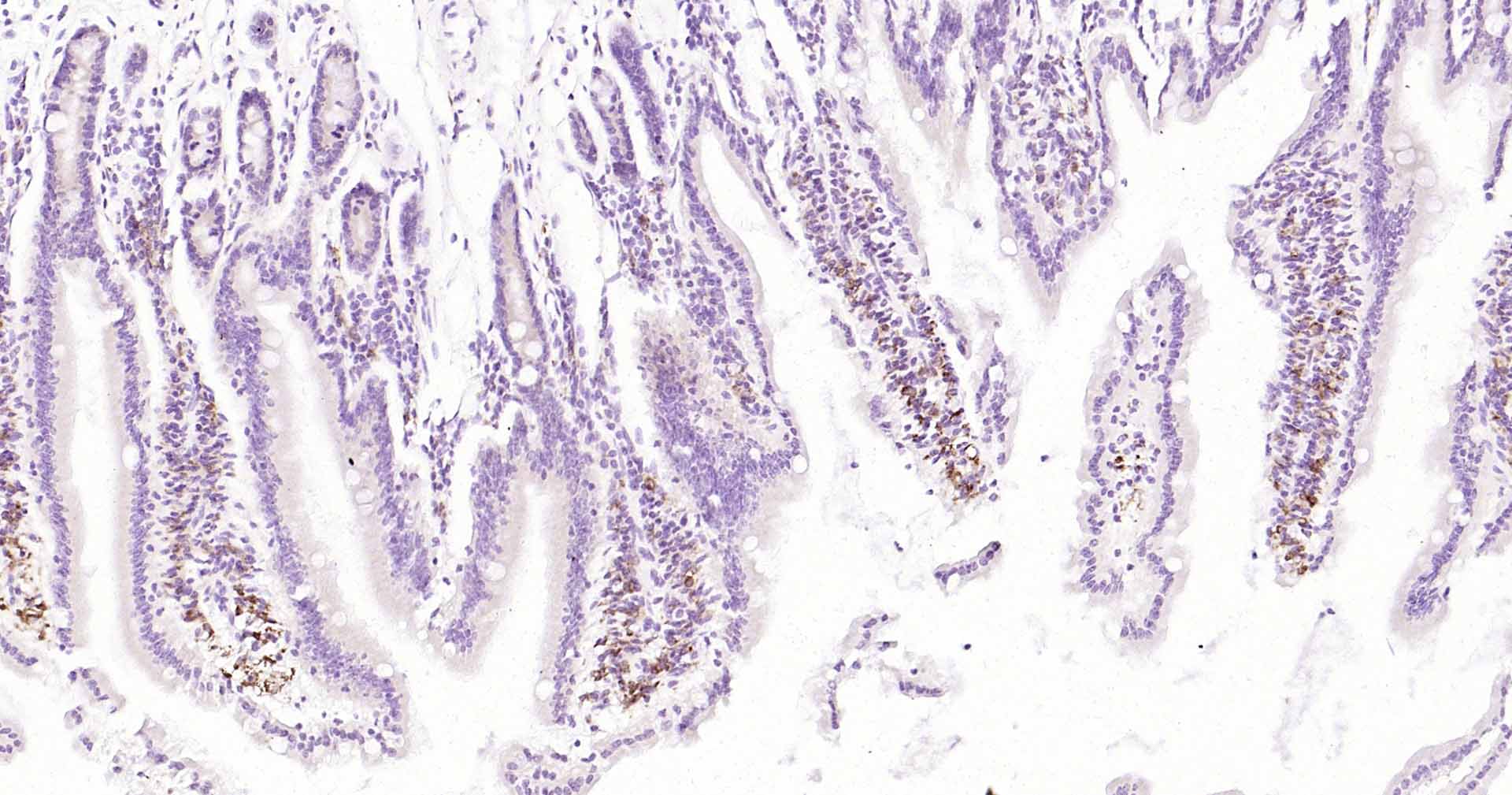 CD68抗体-bs-20402R