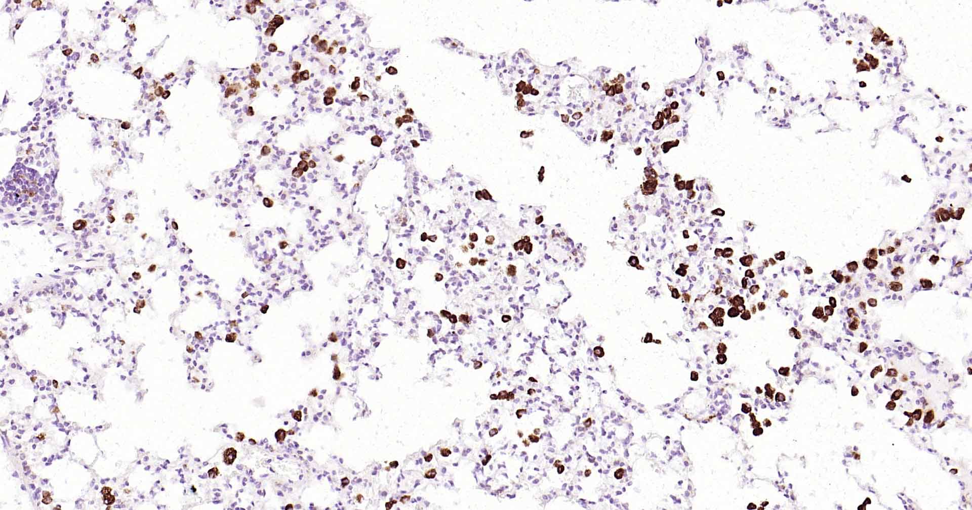 CD68抗体-bs-20402R