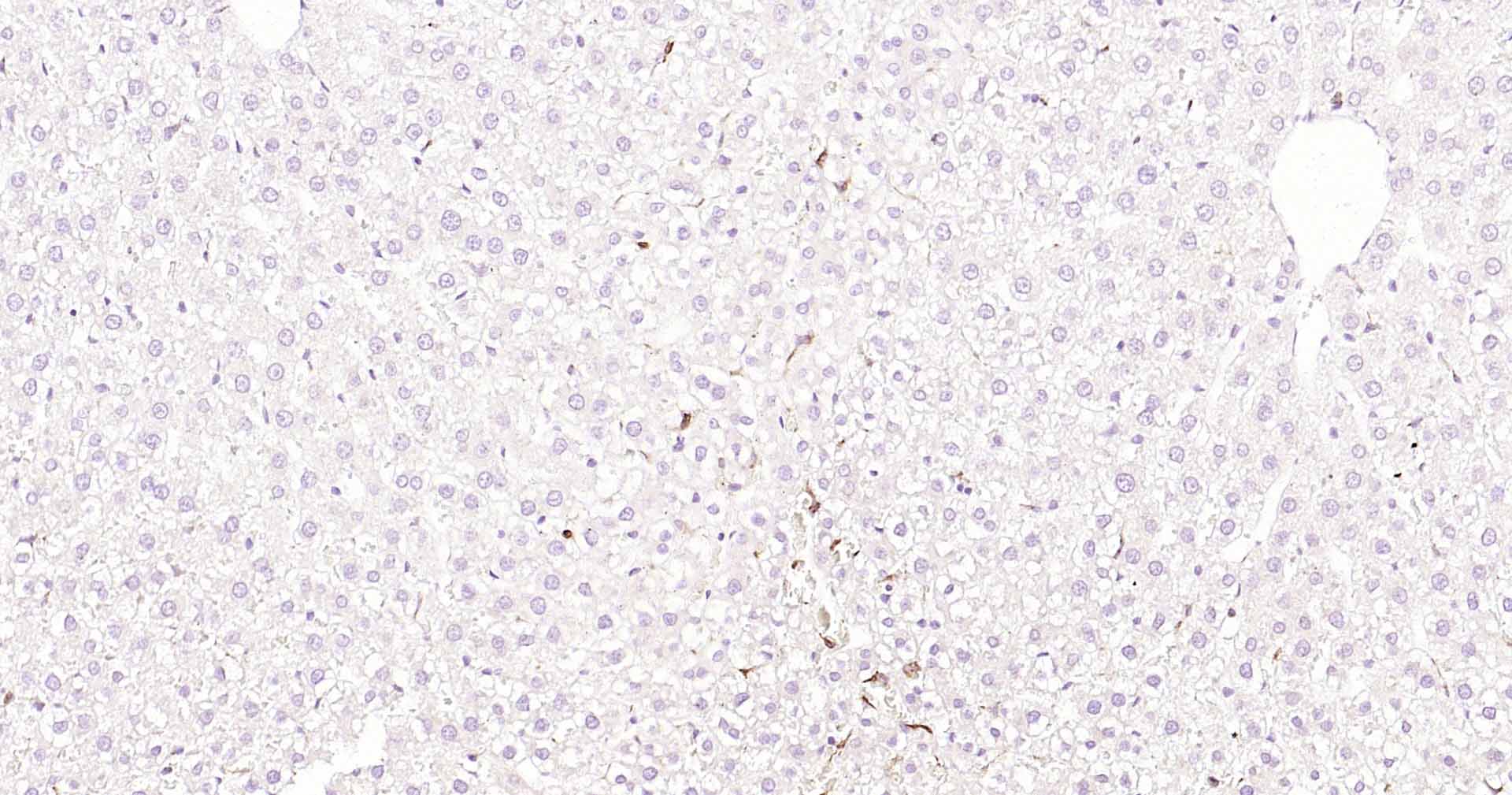 CD68抗体-bs-20402R