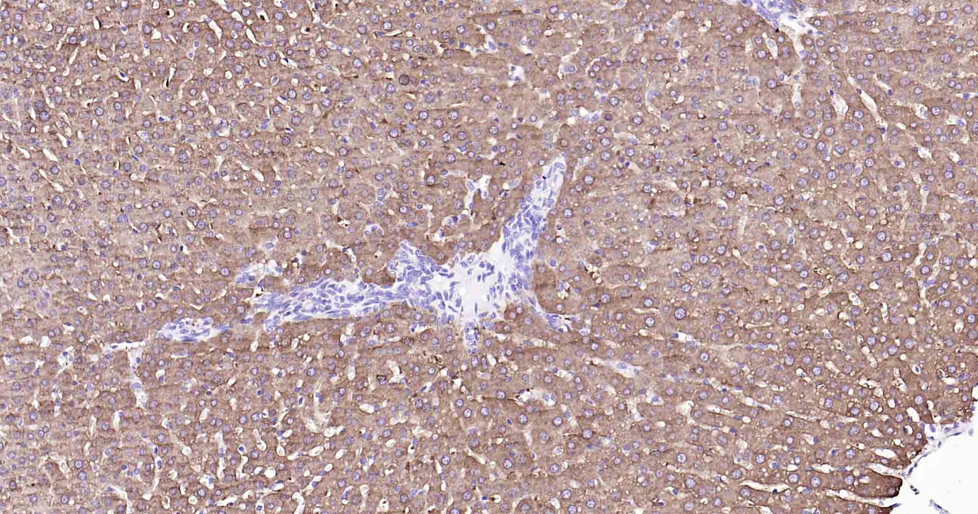 乙醛脱氢酶1蛋白家族L1重组兔单抗