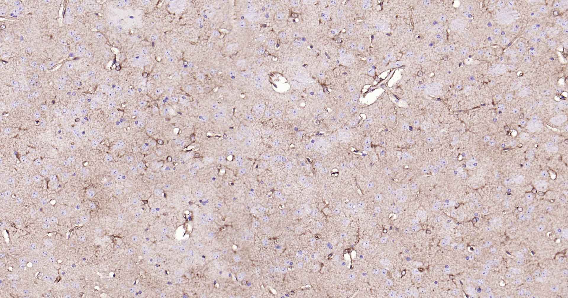 乙醛脱氢酶1蛋白家族L1重组兔单抗