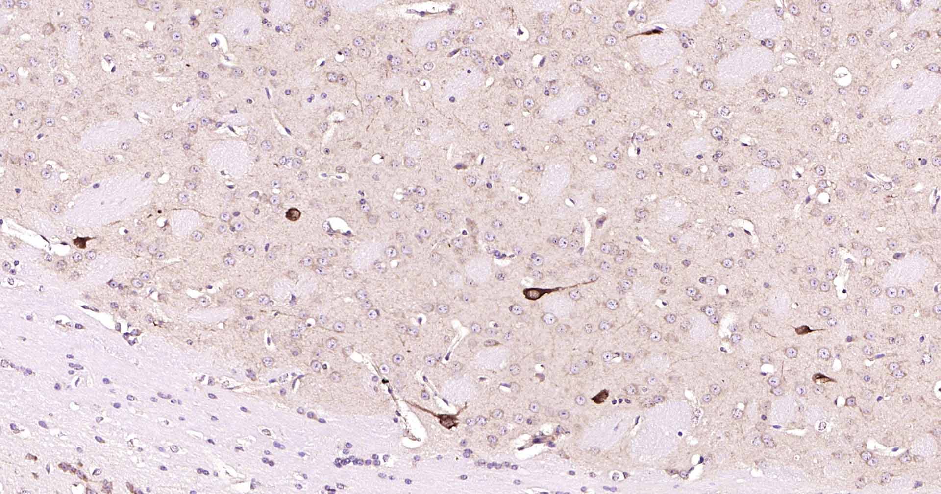 ChAT胆碱乙酰转移酶重组兔单抗