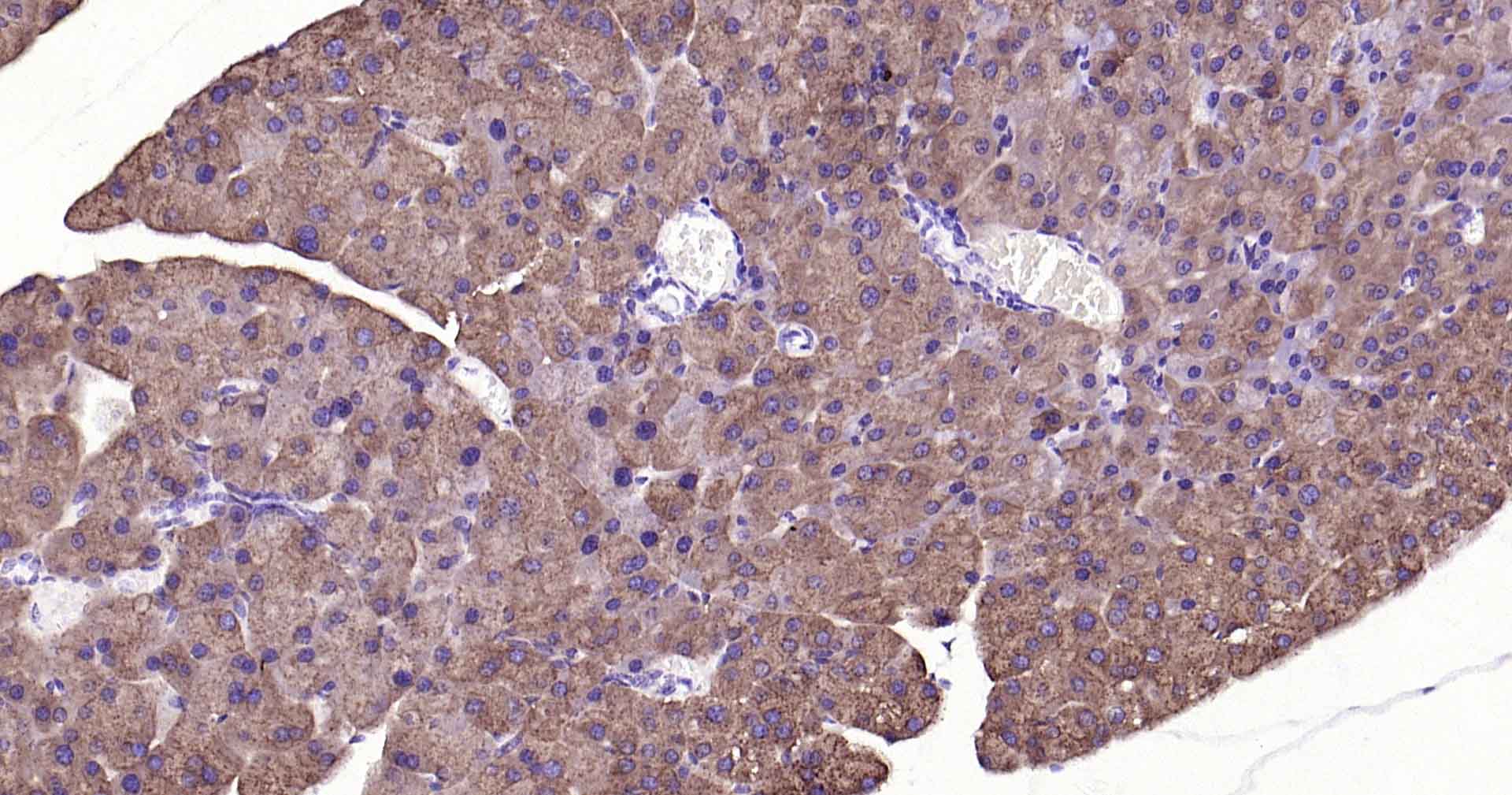 乙醛脱氢酶1蛋白家族L1重组兔单抗