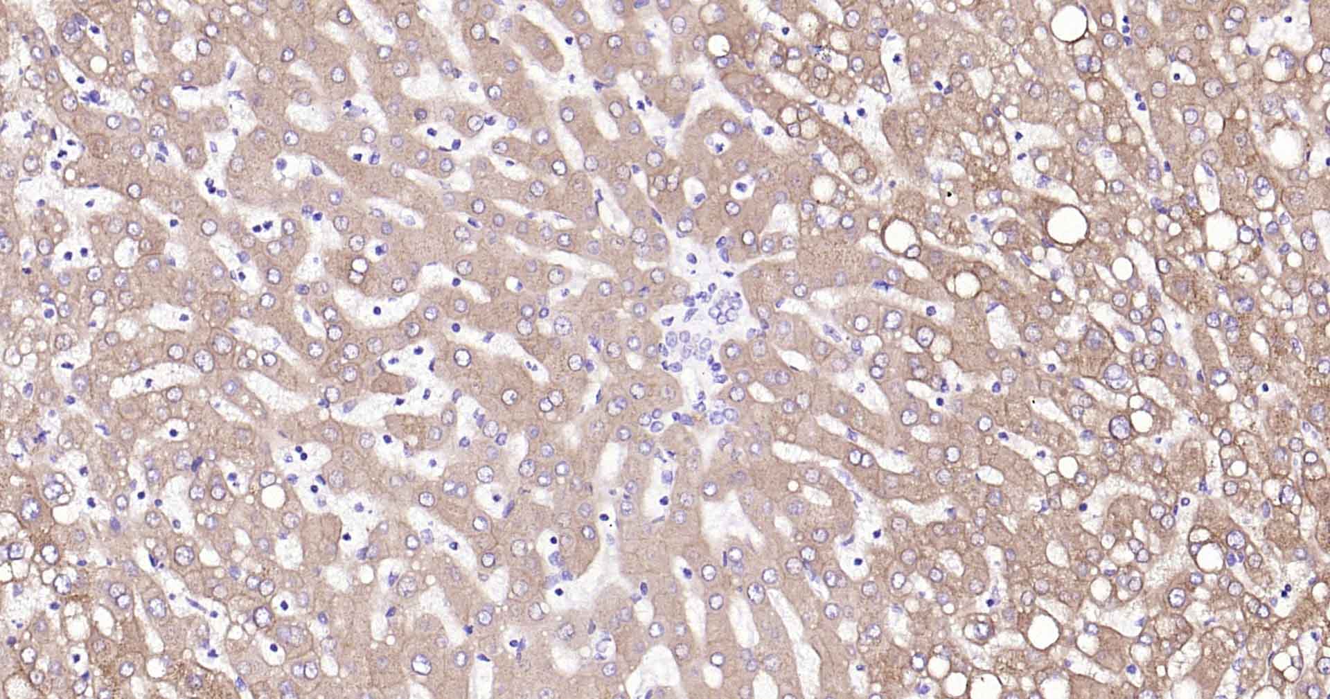 乙醛脱氢酶1蛋白家族L1重组兔单抗