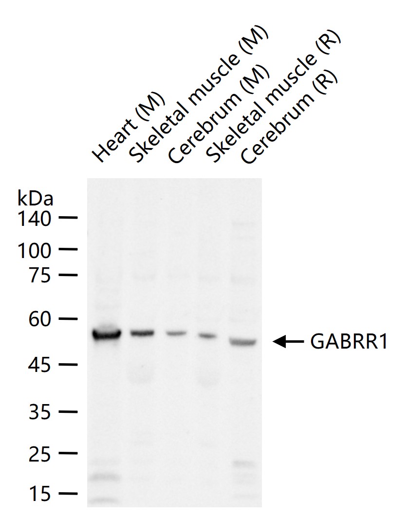 G氨基丁酸A型受体rho1/GABAA Rρ1抗体-bs-12084R