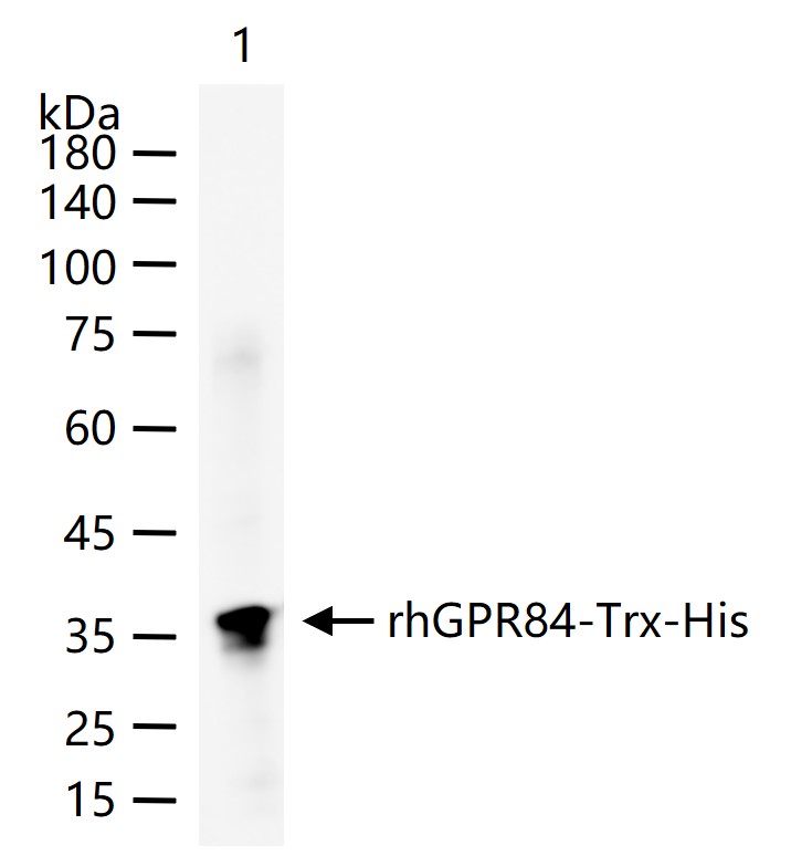 G蛋白偶联受体84重组兔单抗