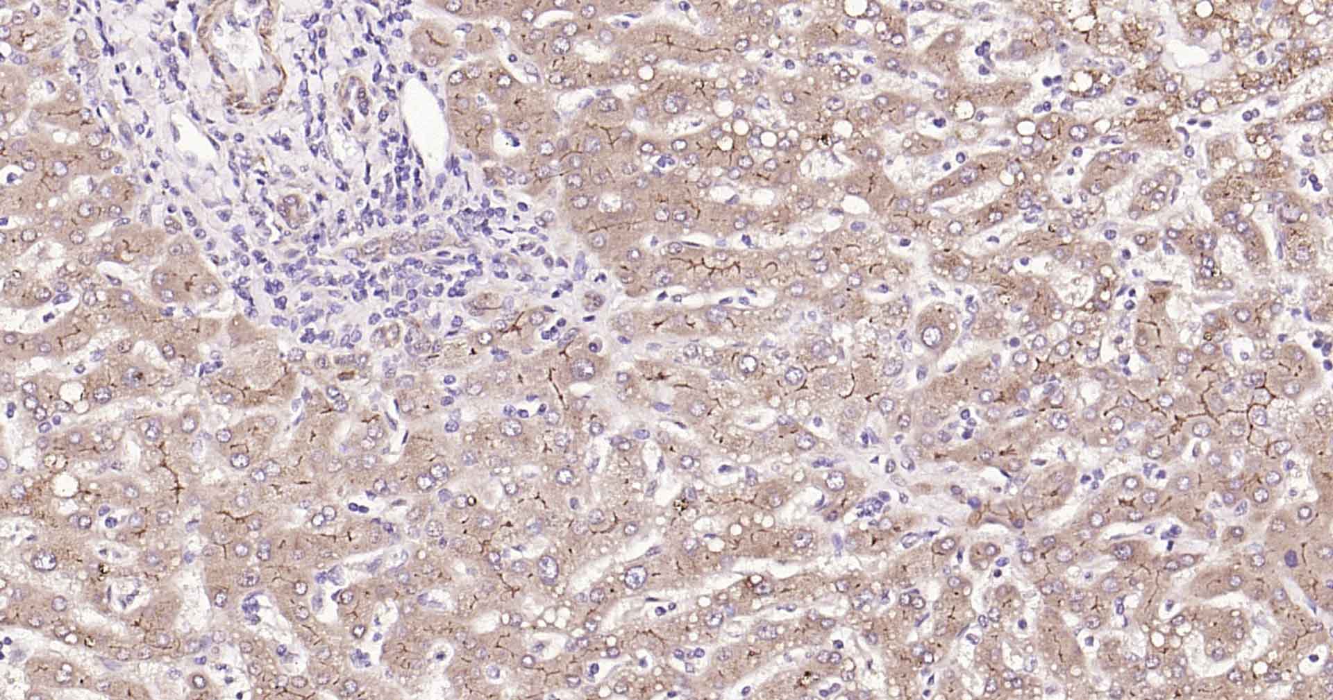 多药耐药相关蛋白2重组兔单抗