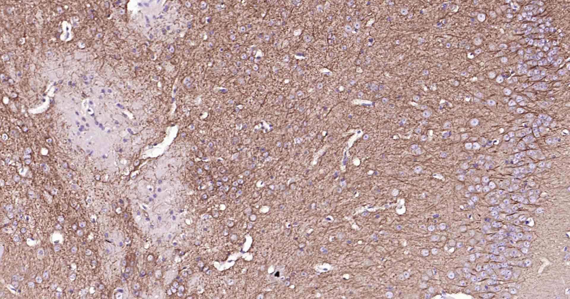 MAP2 Rabbit pAb (一抗) - IHC-P,IHC-F,IF | Bioss