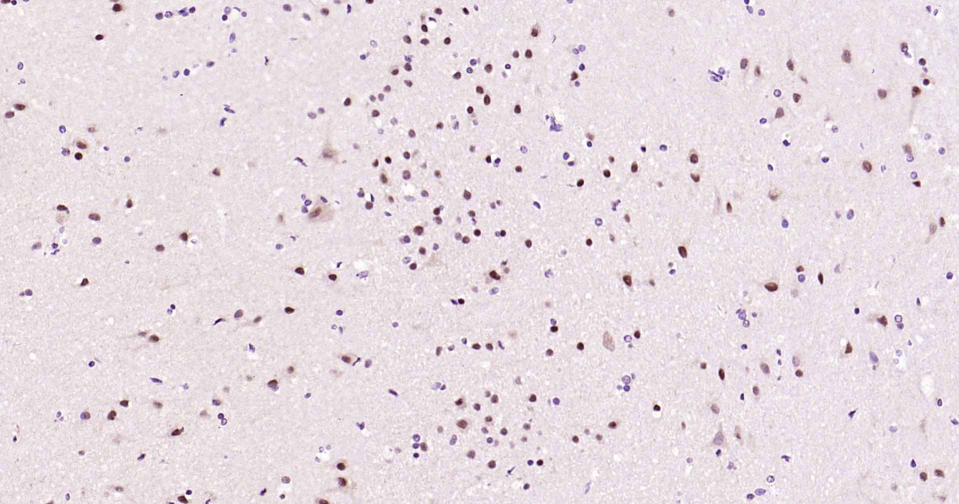 SOX1 Recombinant Rabbit mAb (一抗) - IHC-P,IHC-F,IF,ICC/IF | Bioss