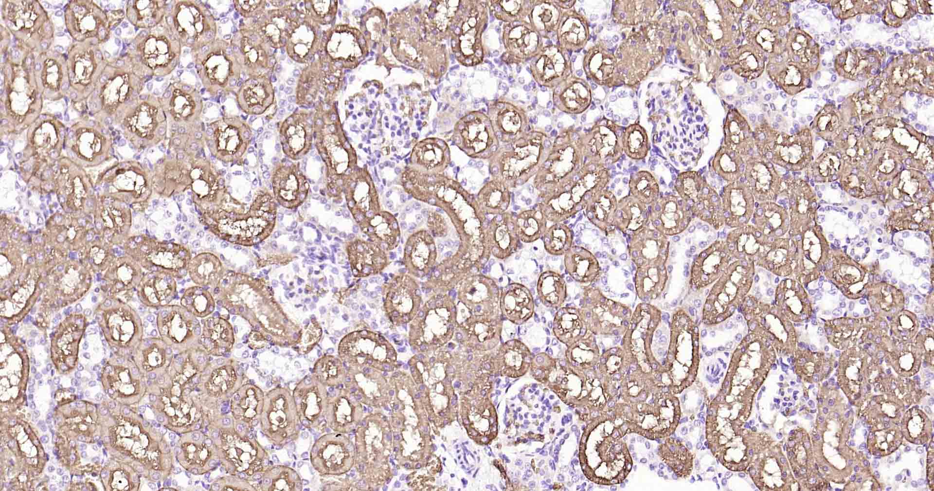 水通道蛋白1重组兔单抗