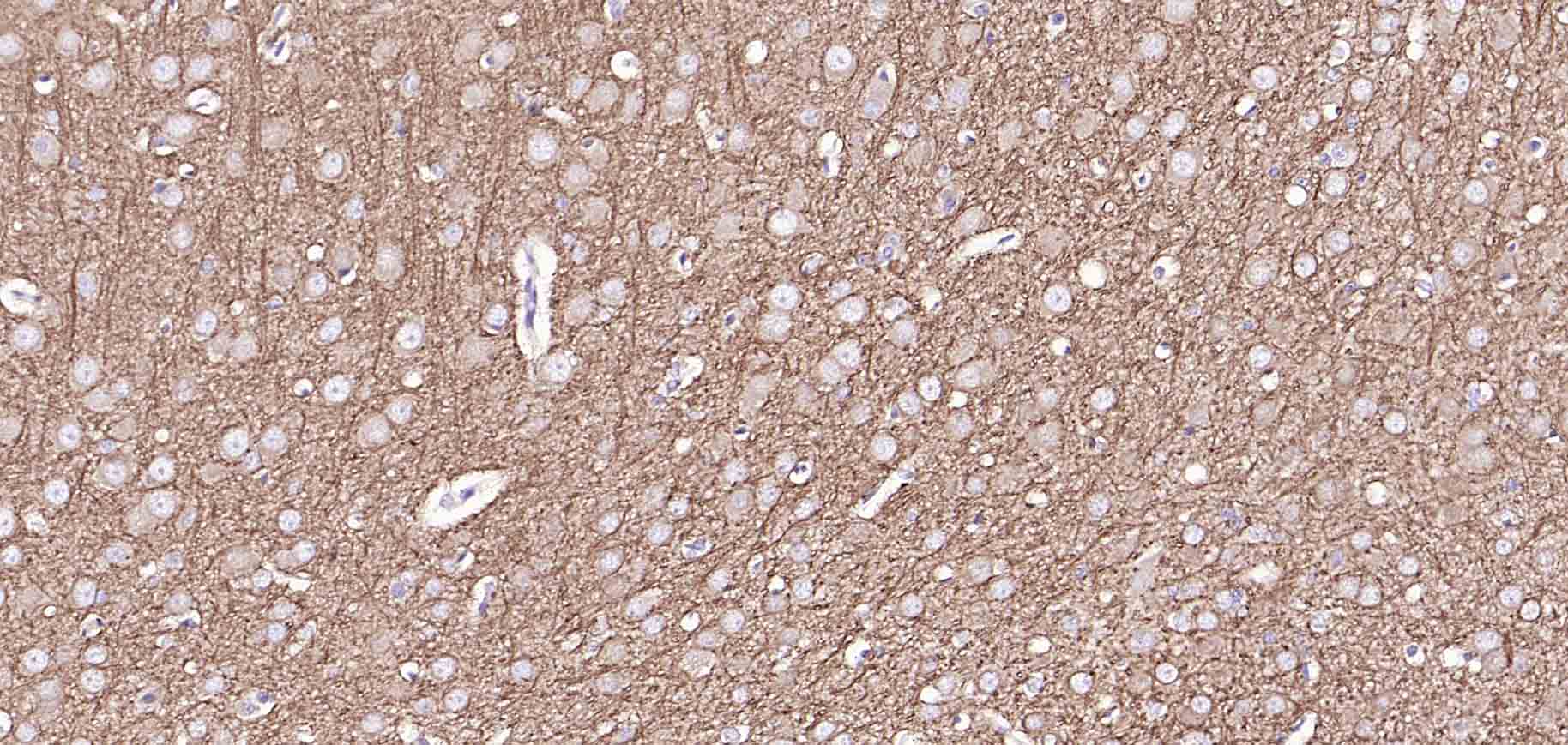 微管相关蛋白2抗体-bs-34252R